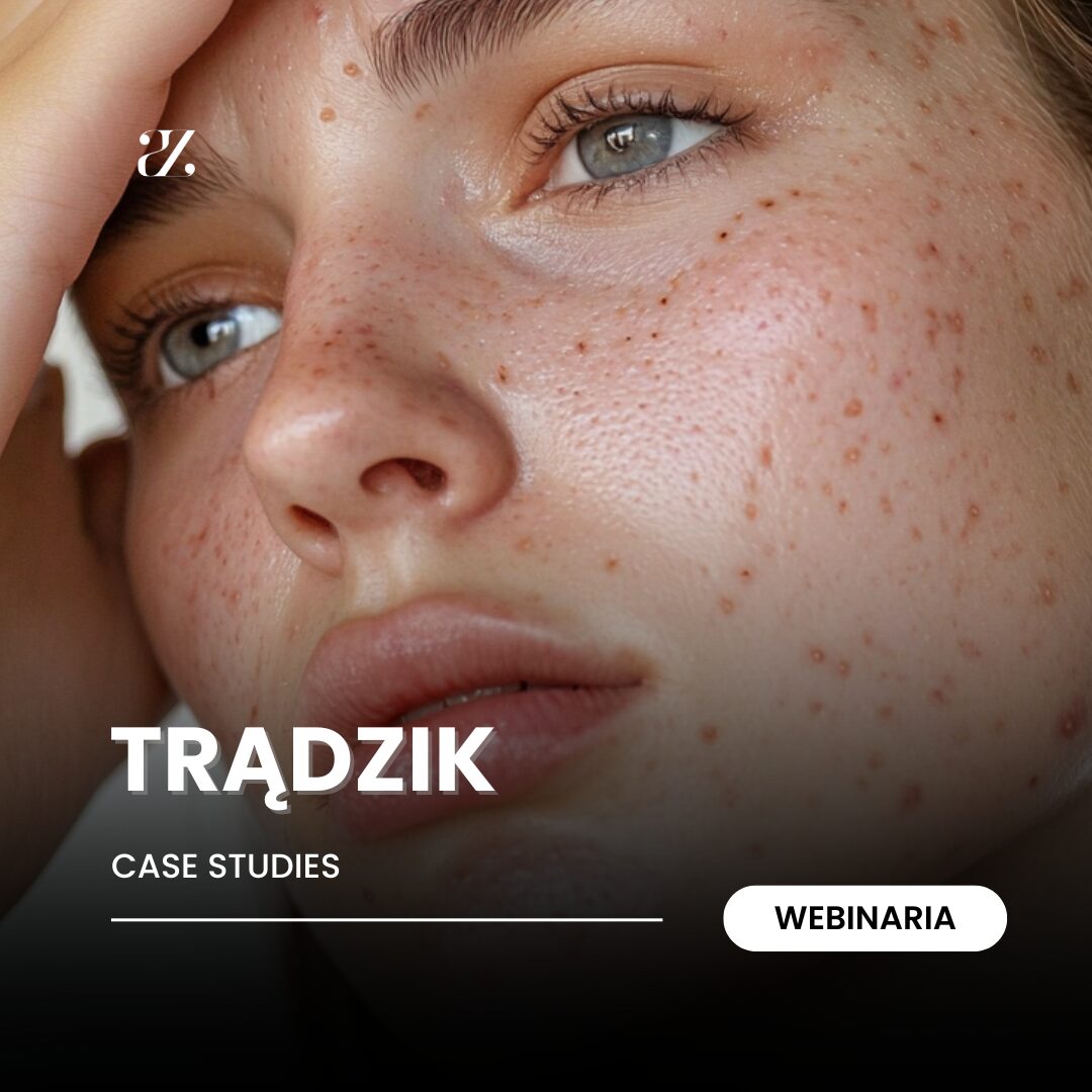 Webinarium: Trądzik - Case studies