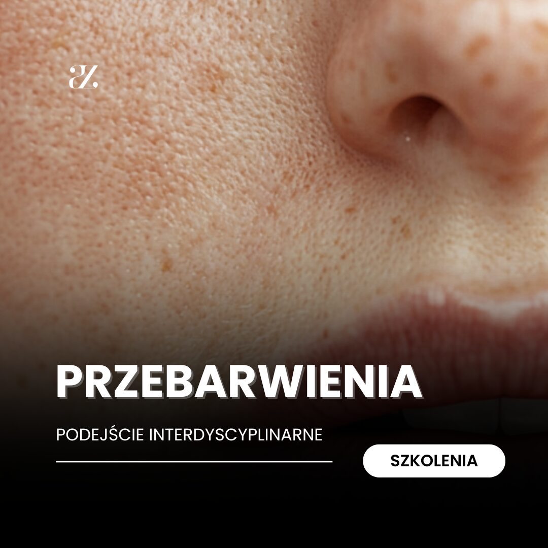 Szkolenie: Przebarwienia – podejście interdyscyplinarne