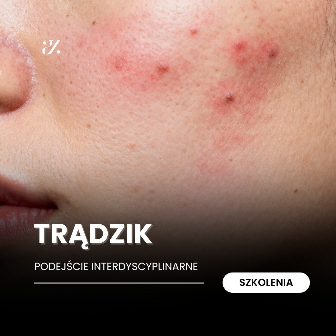 Szkolenie: Trądzik – podejście interdyscyplinarne